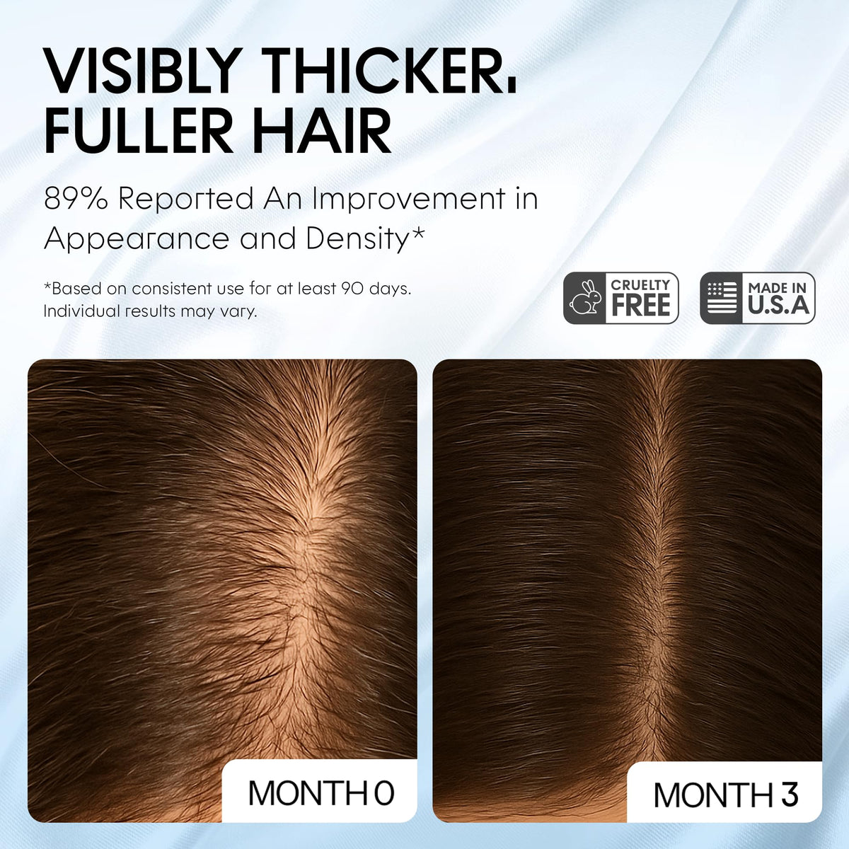 Scalp Delivery Procapil Capixyl serum bottle promotes healthier growth cycles.