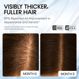 Scalp Delivery Procapil Capixyl serum bottle promotes healthier growth cycles.