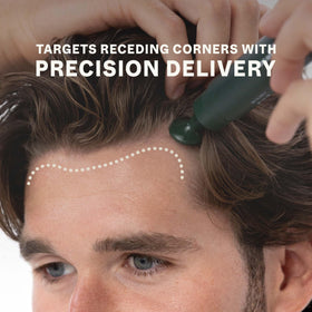 Bio-Pilixin targets receding corners for a fuller hairline appearance.