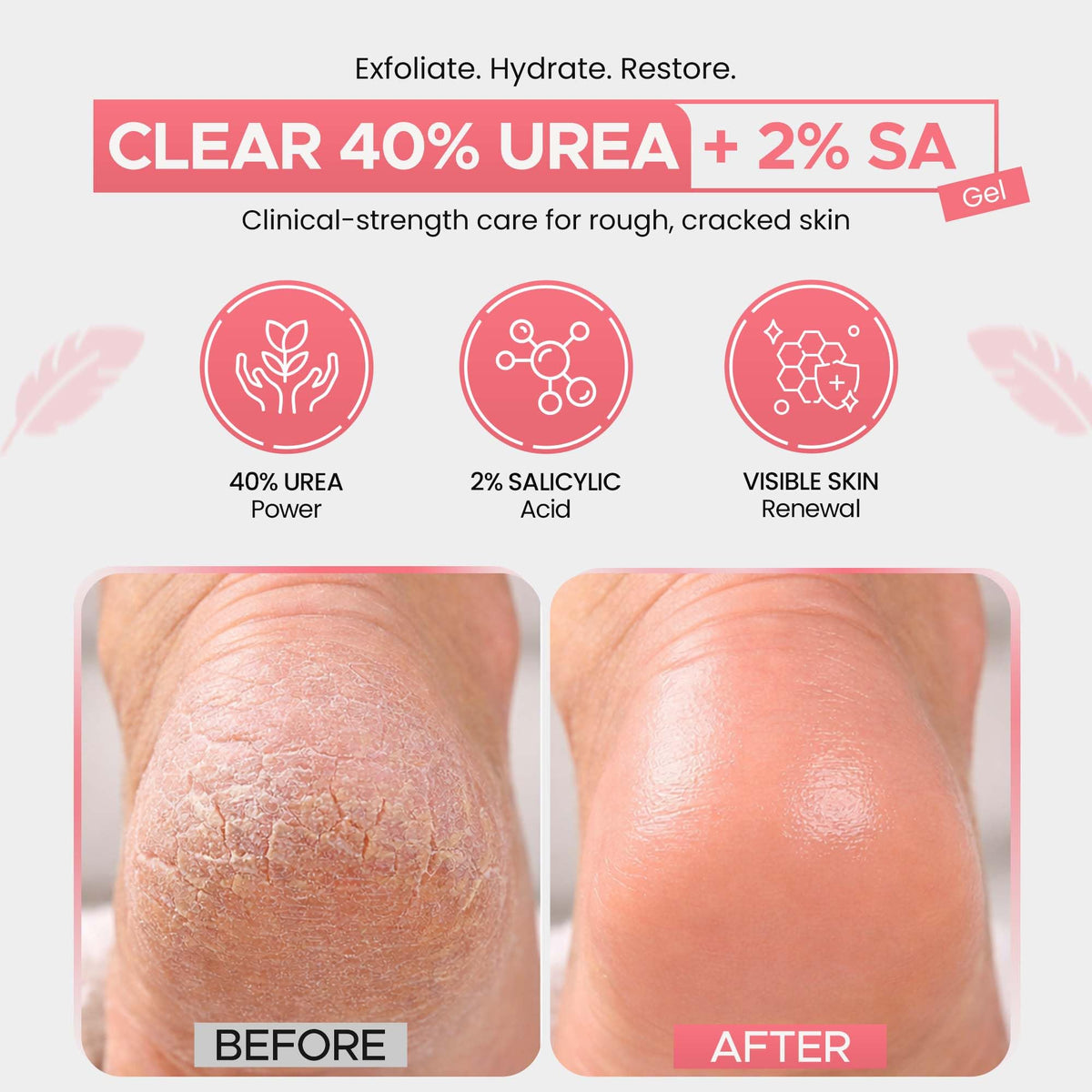 Scientific Solutions Global CLEAR 40 +SA Gel hand application smooths rough skin.