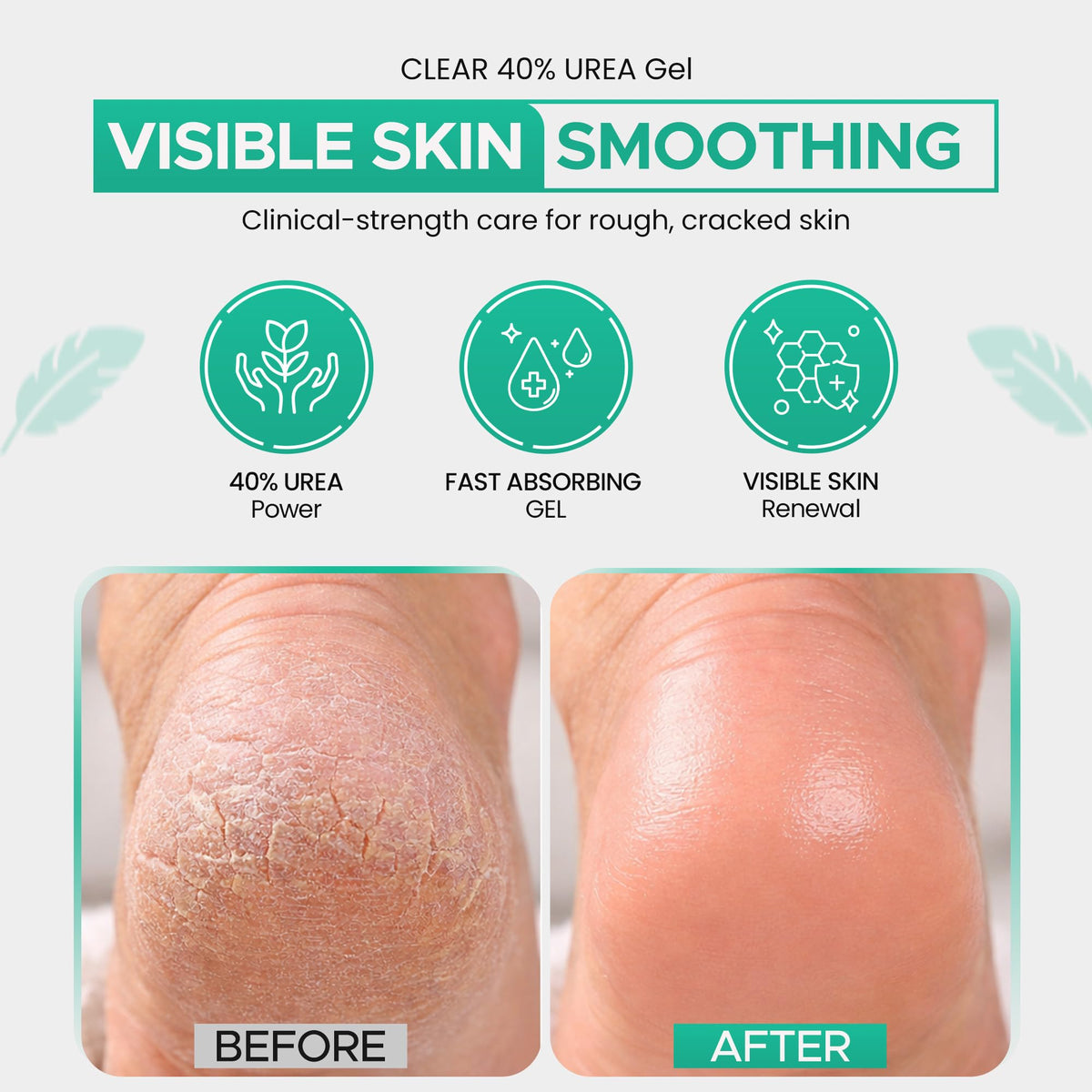 CLEAR 40 Urea Gel massaged into dry heels for soft feet.
