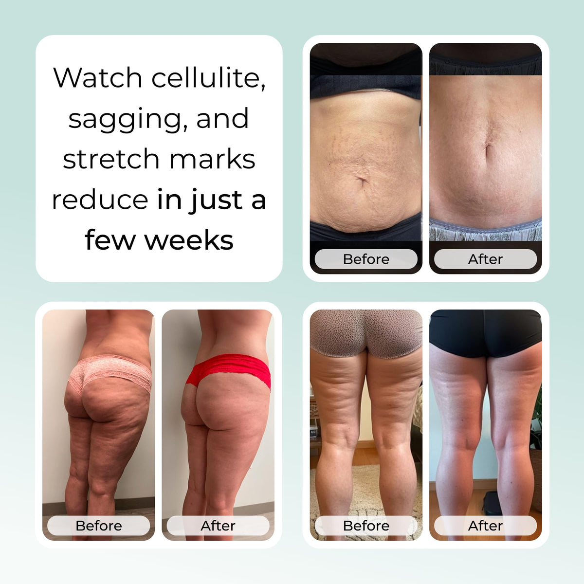 Silky texture of Sculpiflex stretch mark cream