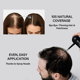 Seaboll hairline coverage via targeted spray blends seamlessly.