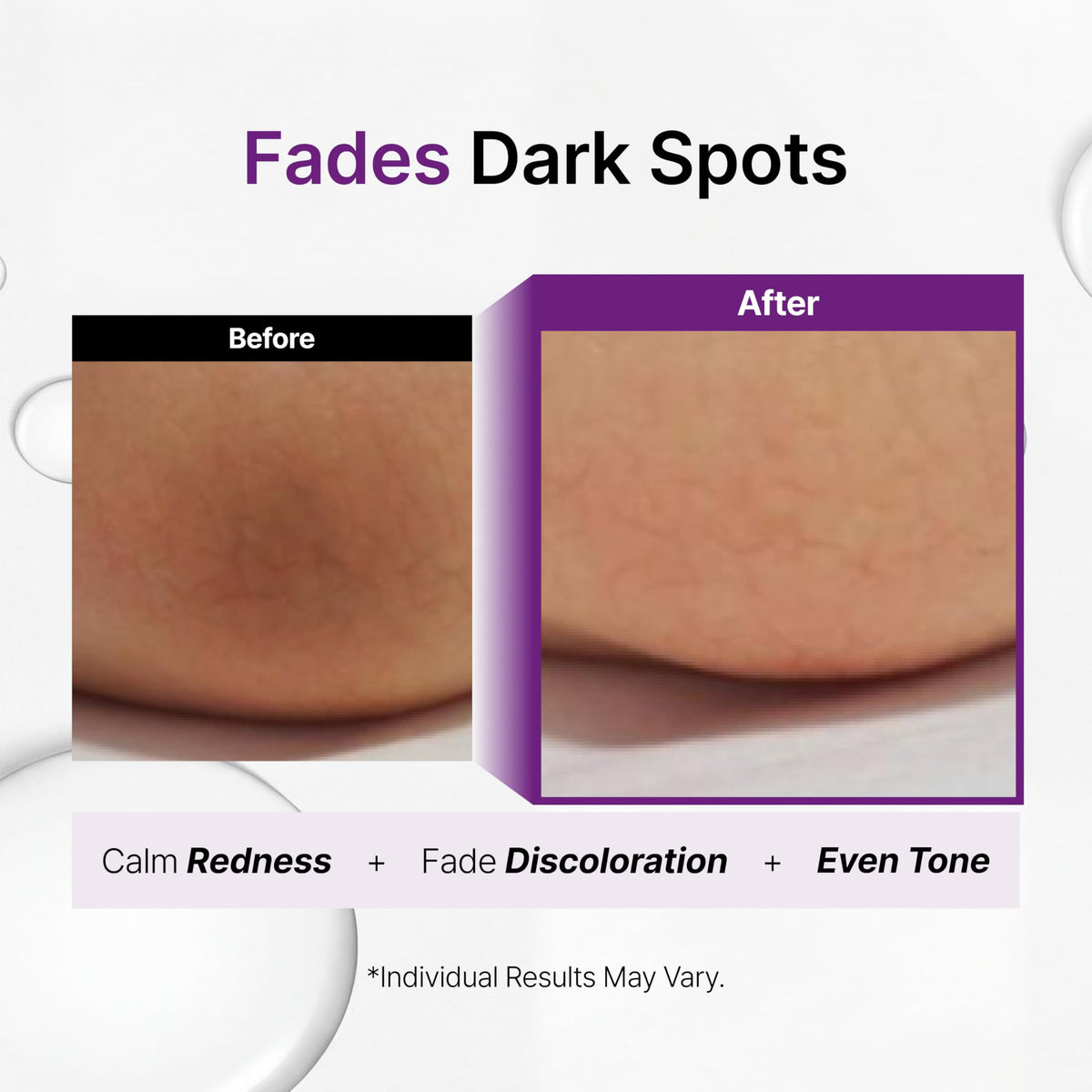 Snow Glowing Spot Gel on the face for even tone