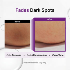 Snow Glowing Spot Gel on the face for even tone