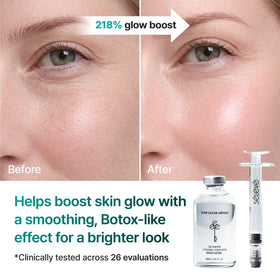 Application on dry, sensitive skin demonstrating soothing hydration from SELEVE ampoule