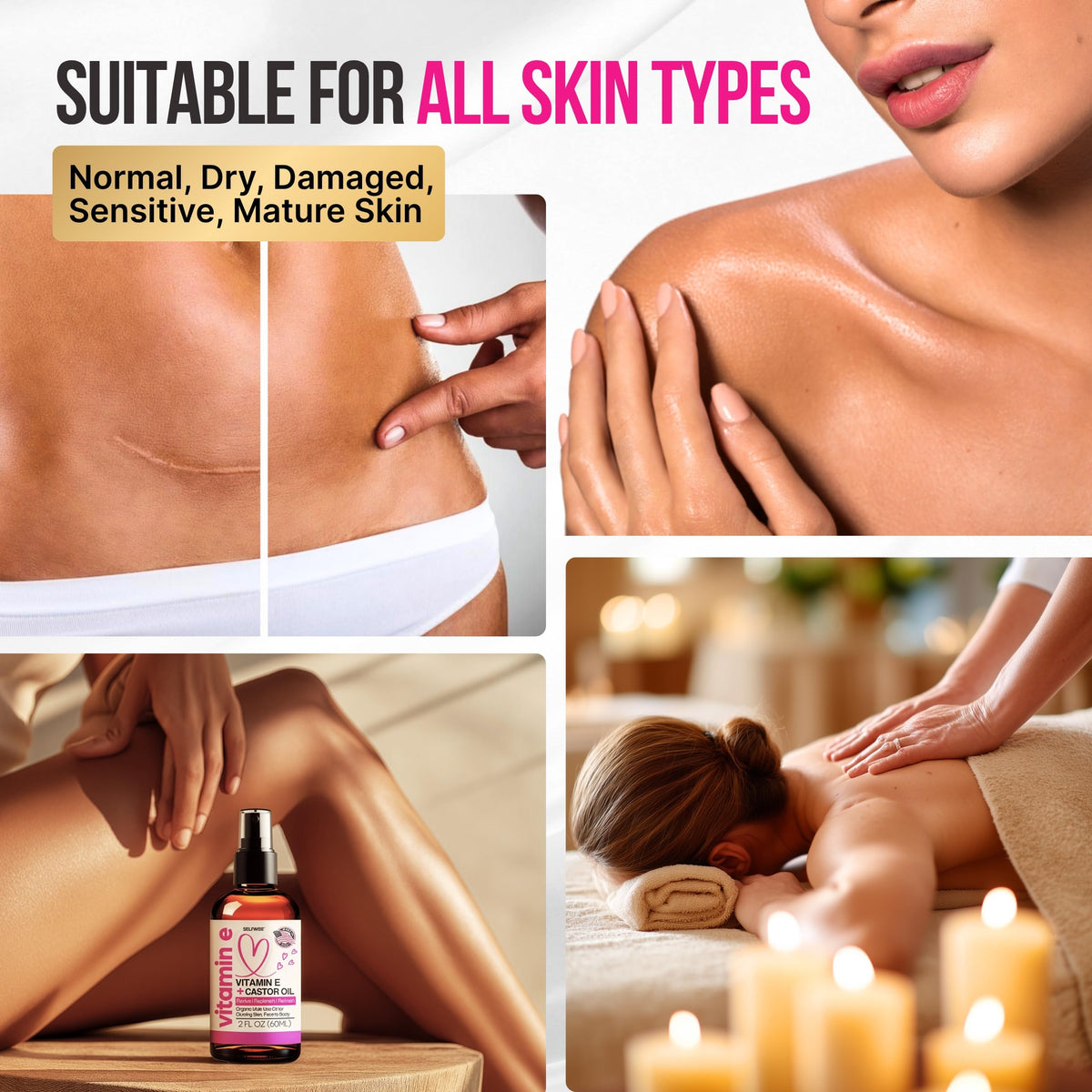 SelfWISE stretch marks care focus for hydrated, supple skin.
