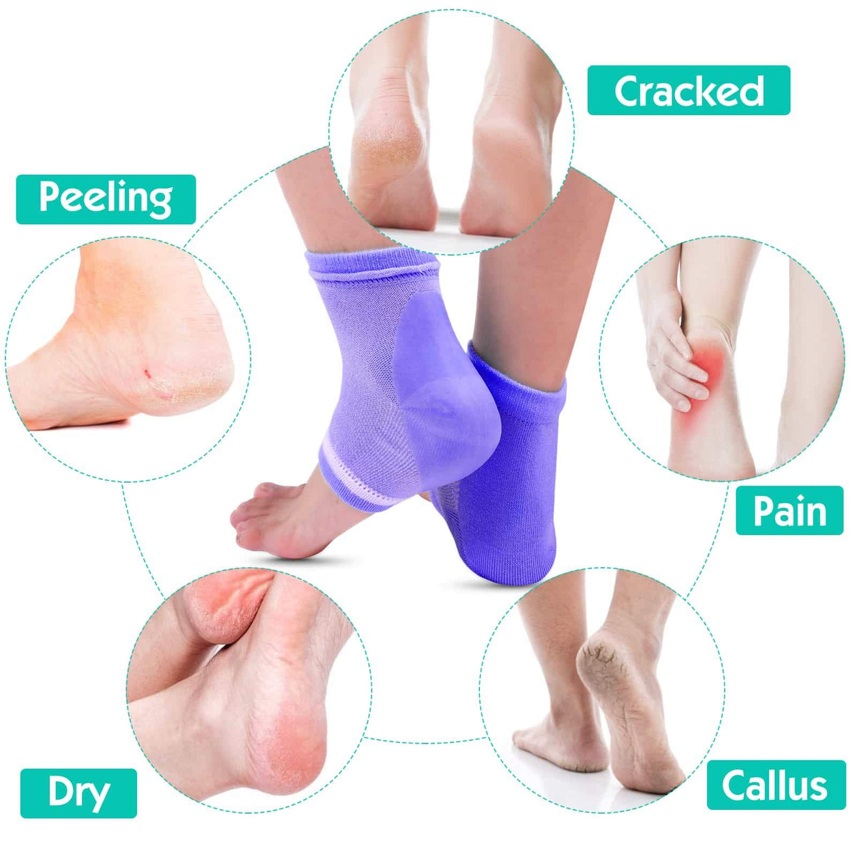 Selizo blue open-toe socks with gel interior for long-lasting hydration