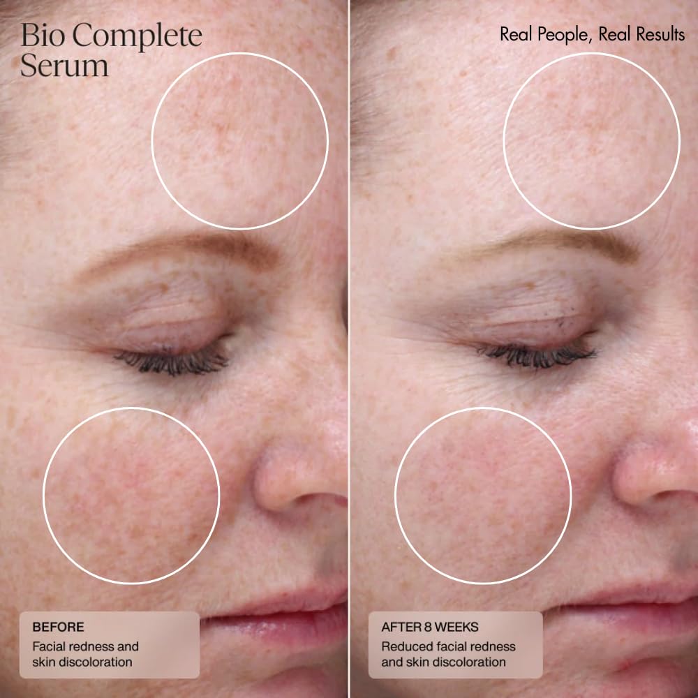 Sente Bio Complete Serum clinical improvement graphic illustrating skin evenness