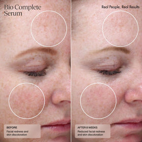 Sente Bio Complete Serum clinical improvement graphic illustrating skin evenness