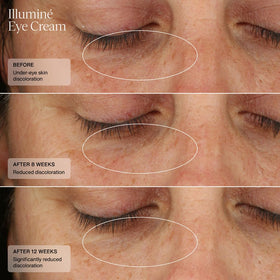 Sente Illumine Eye Cream ingredients label close-up featuring HSA and Niacinamide