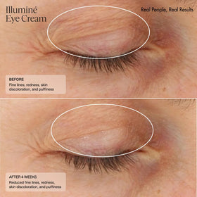 Sente Illumine Eye Cream packaging box with premium branding