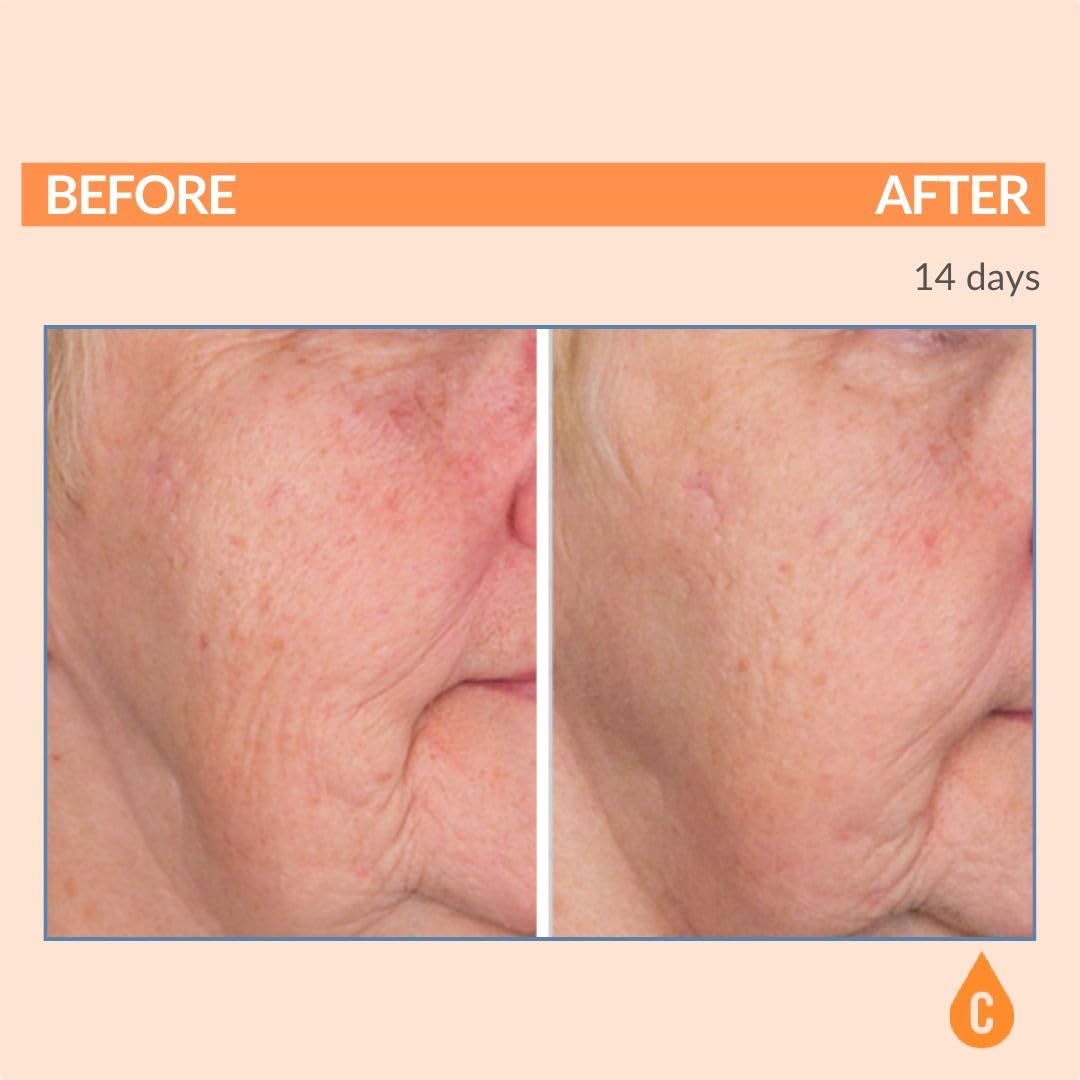 Serious Skincare brightening skin closeup with Vitamin C complex
