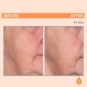 Serious Skincare brightening skin closeup with Vitamin C complex