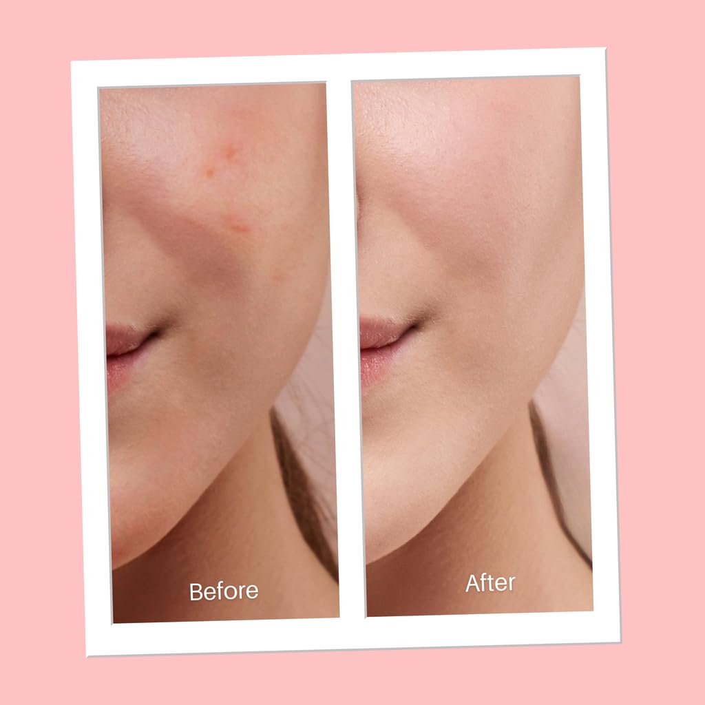 Illustration of sulfur ingredient in Serious Skincare DRY-LO for oil absorption.