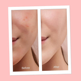 Illustration of sulfur ingredient in Serious Skincare DRY-LO for oil absorption.