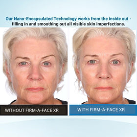 Serious Skincare Firm A Face XR on face and neck application demonstrates tightening