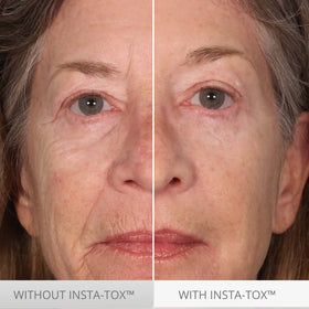 Serious Skincare INSTA-TOX serum being dispensed close-up on skin.