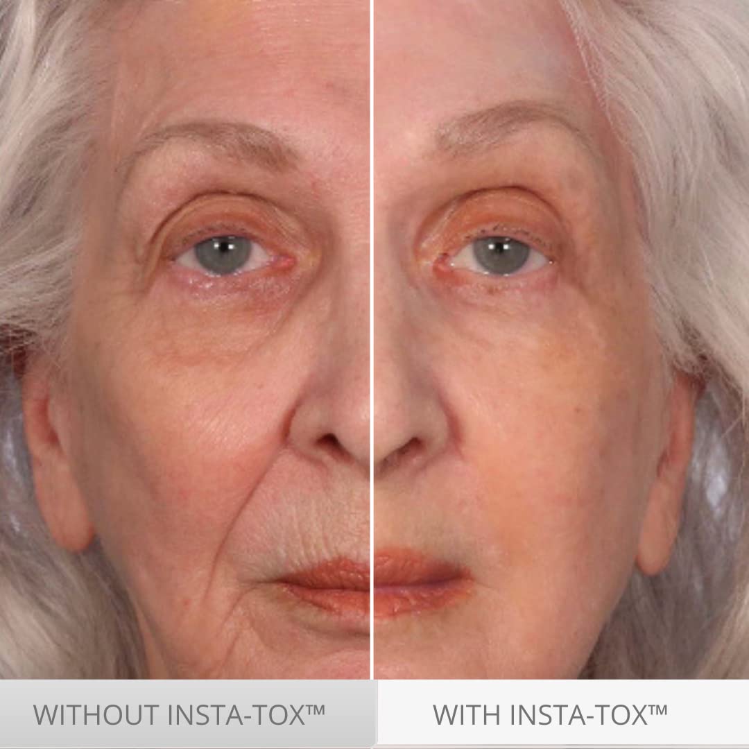 Serious Skincare INSTA-TOX trio packaging on display for value.