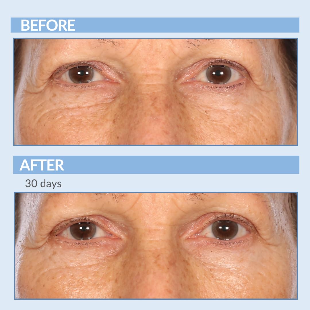 Tube label notes four-million-iu retinol potency in Serious Skincare Cream.