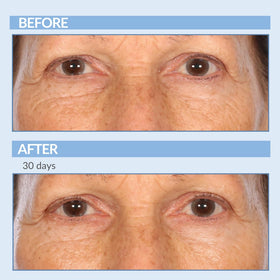 Tube label notes four-million-iu retinol potency in Serious Skincare Cream.
