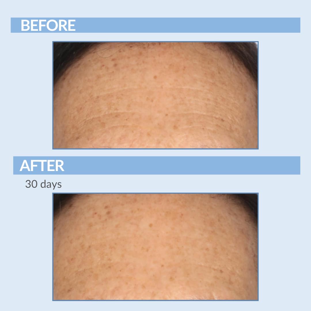 Green tea and ingredients provide antioxidants and hydration in Serious Skincare Retinol Cream.