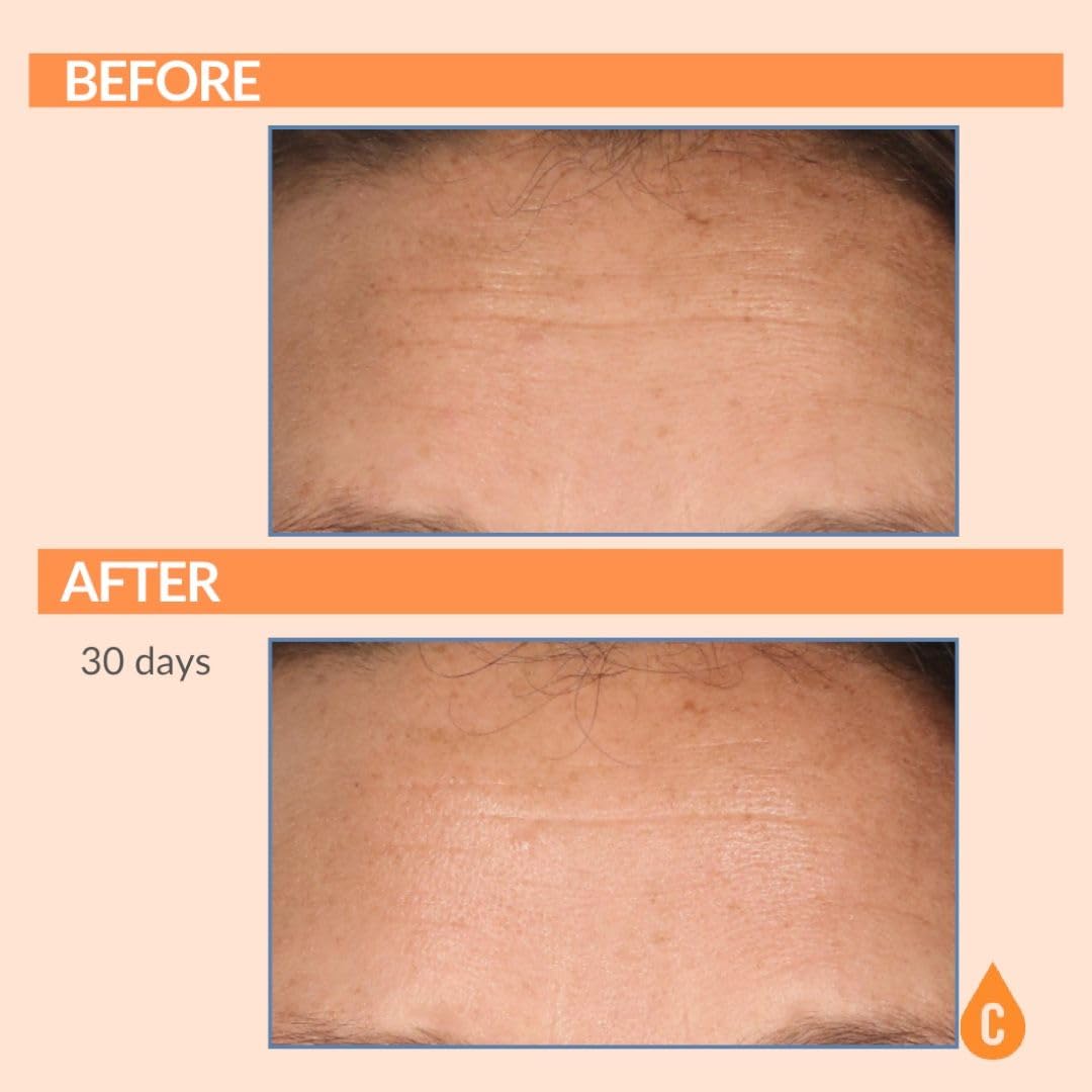 Serious Skincare Serious-C3 Plasma Restore hydrolyzed collagen ingredient spotlight