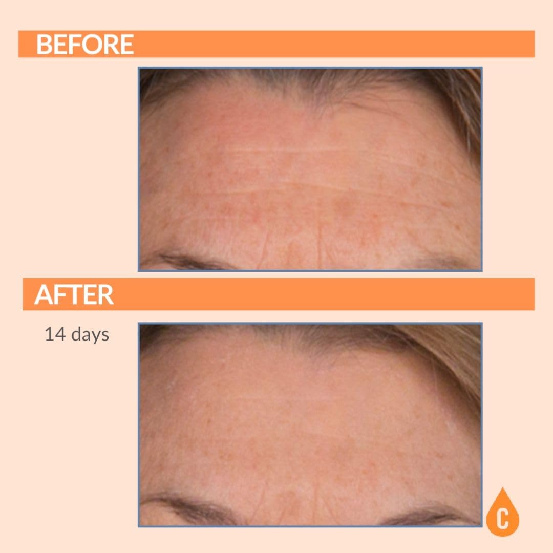 Serious Skincare SPF 30 no white cast application on diverse skin tones