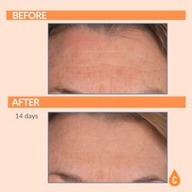 Serious Skincare SPF 30 no white cast application on diverse skin tones
