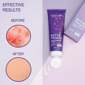 Seroflora moisturizing cream action demonstrates skin hydration