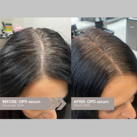 SEVEN Satara Opti serum dropper used for scalp massage to support growth and color.
