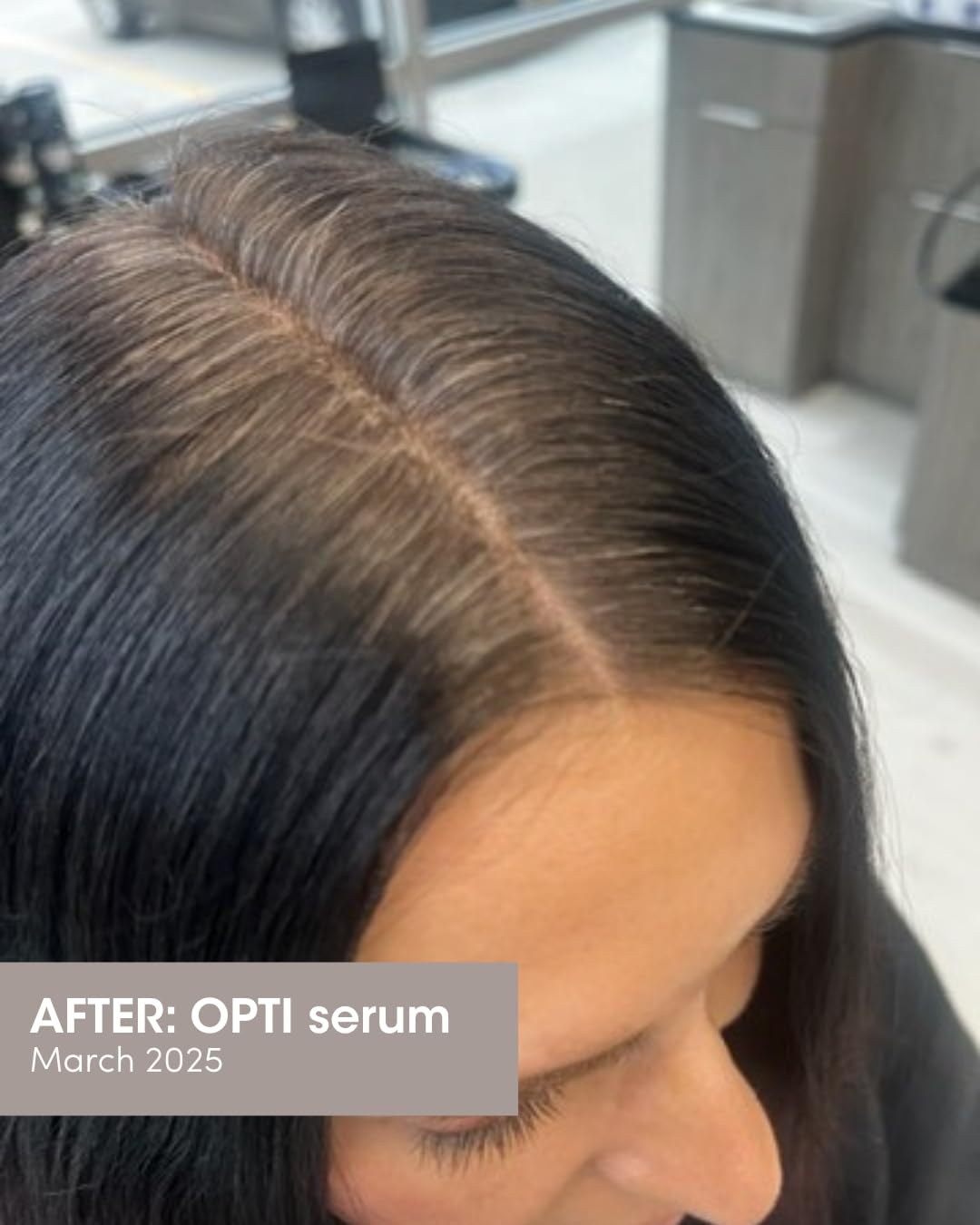 Close-up of ingredients panel emphasizes Procapil and Capixyl for hair health.