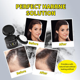 Sevich Hairline Powder compact case for travel-ready use.