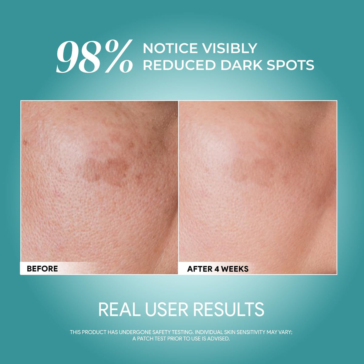 SEYOUL Advanced Serum dropper action for easy daily application