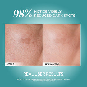SEYOUL Advanced Serum dropper action for easy daily application