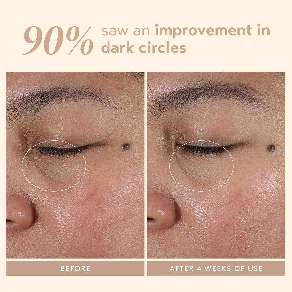 Shani Darden Intensive Eye Renewal Cream niacinamide graphic shows brightening benefits.