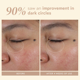 Shani Darden Intensive Eye Renewal Cream niacinamide graphic shows brightening benefits.