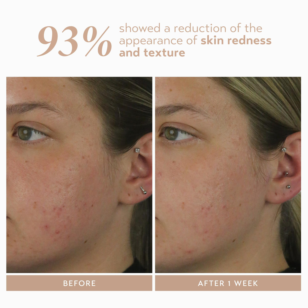 Aloe extract adds soothing moisture in SHANI DARDEN Rescue Serum