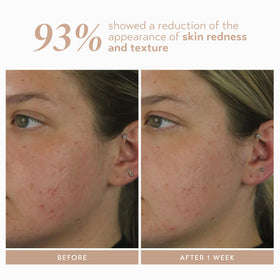 Aloe extract adds soothing moisture in SHANI DARDEN Rescue Serum