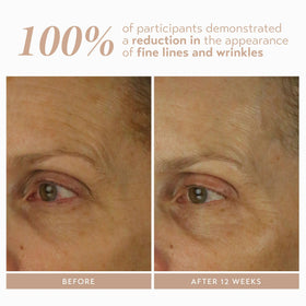 Gentle under-eye area application with Retinol Reform in a calm routine.