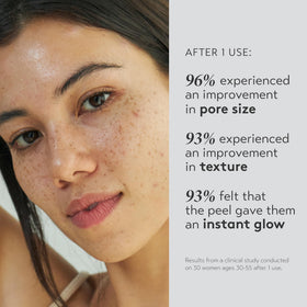 SHANI DARDEN Triple Acid Peel closeup reveals refined skin surface