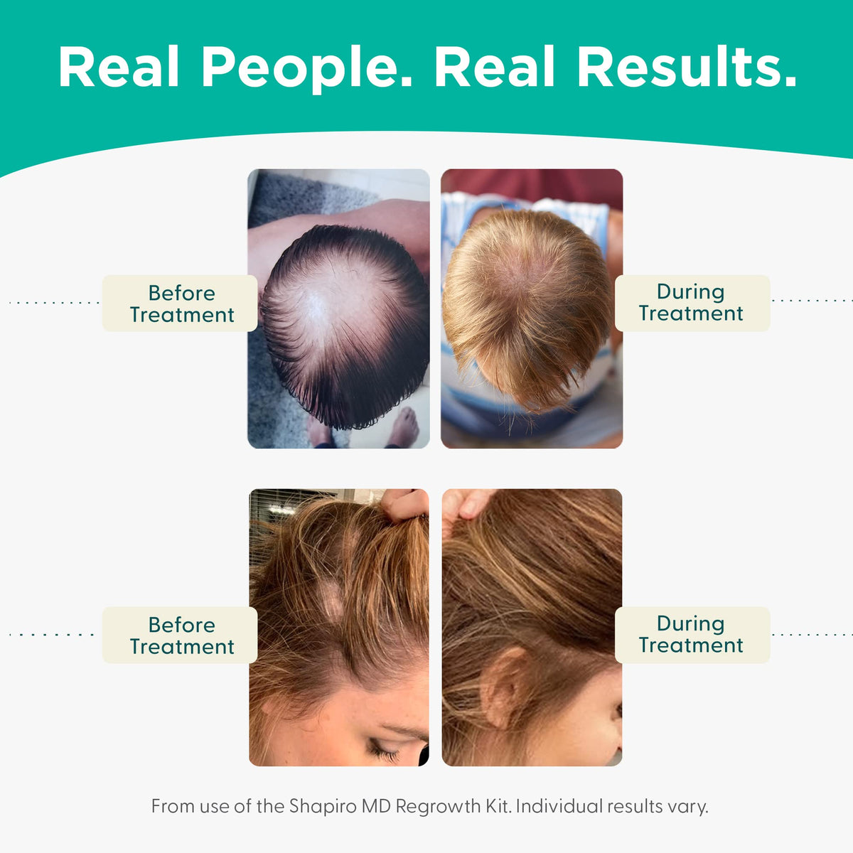 Shapiro MD conditioner rinse scene suggesting fuller-looking hair