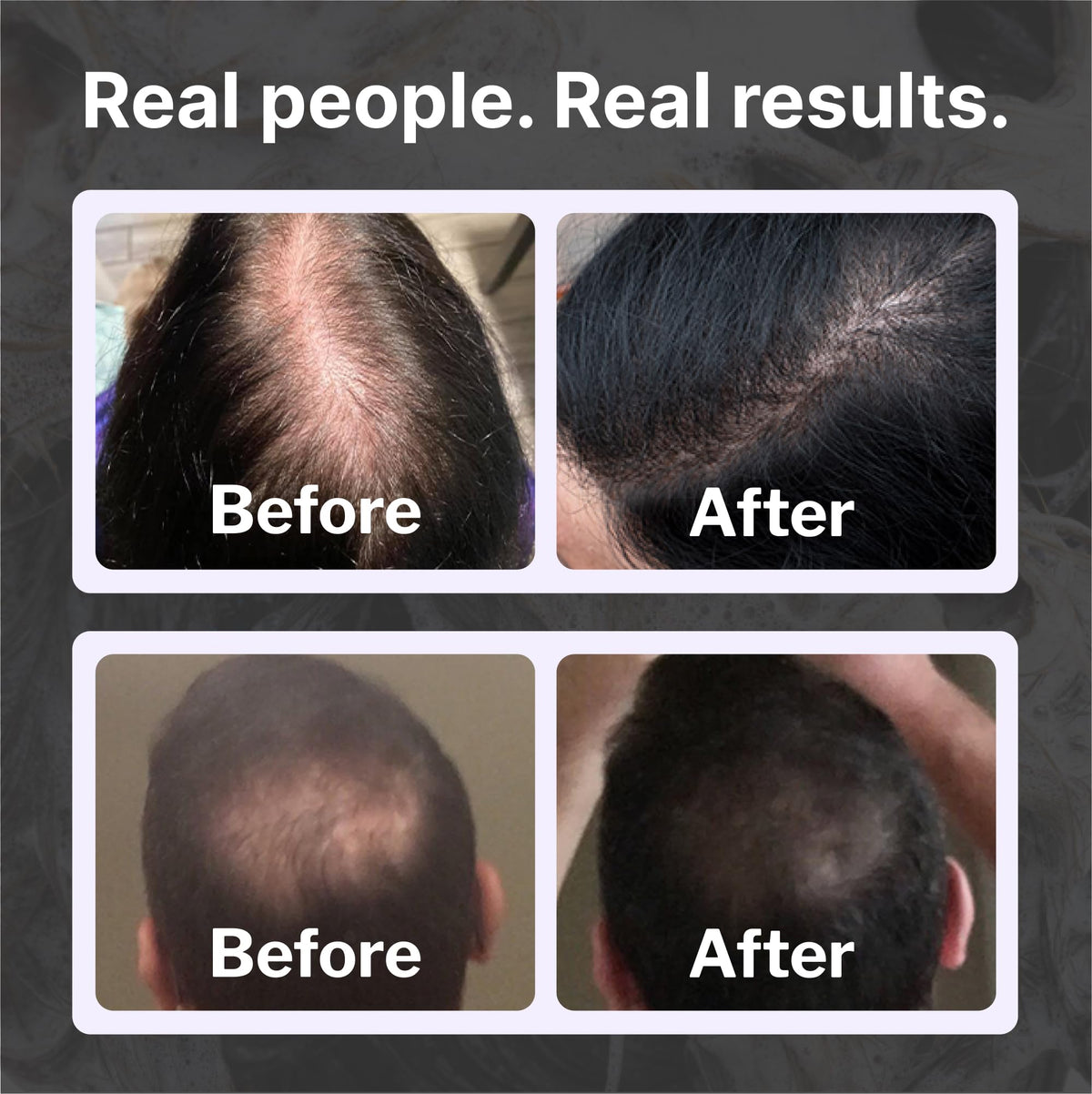Shapiro MD Hair Growth Experts shampoo on sink framing a convenient home routine