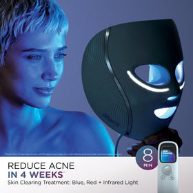 Shark CryoGlow better aging treatment aiming to reduce fine lines