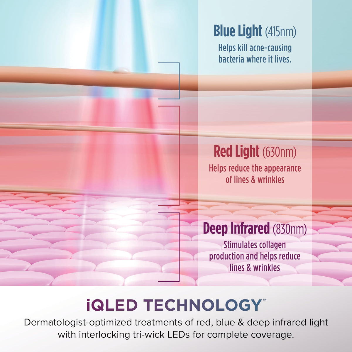 Shark CryoGlow lilac chill color with cooling therapy vibe