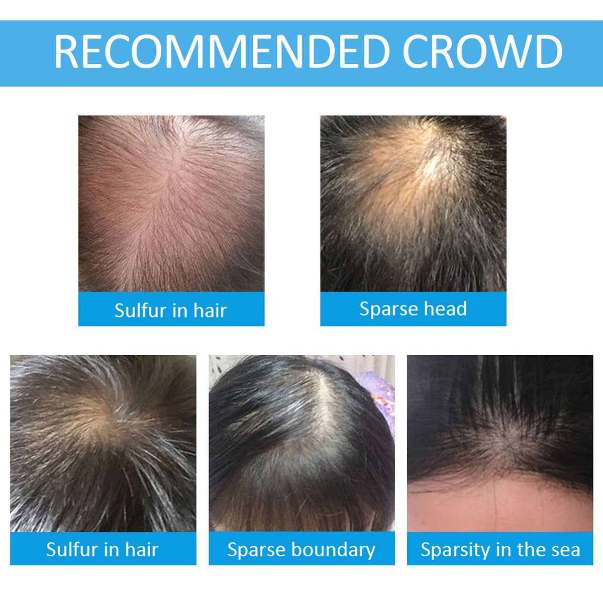 SHIFAKOU keratin fibers texture blends with natural hair for fuller look.
