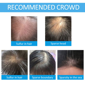 SHIFAKOU keratin fibers texture blends with natural hair for fuller look.
