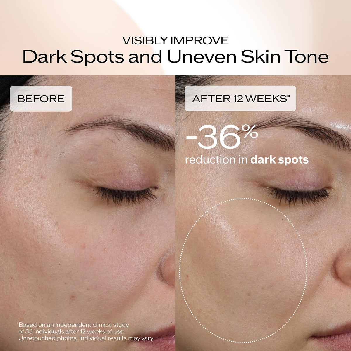 Shiseido Benefiance serum being applied to skin for smooth, even tone