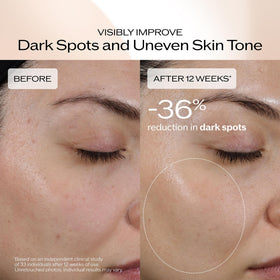 Shiseido Benefiance serum being applied to skin for smooth, even tone