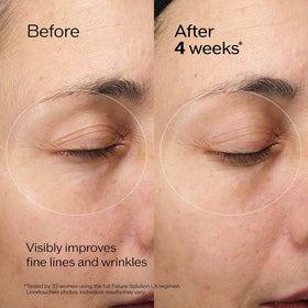 Shiseido Future Solution LX eye-lip cream applied around eye area shows gentle massage for puffiness